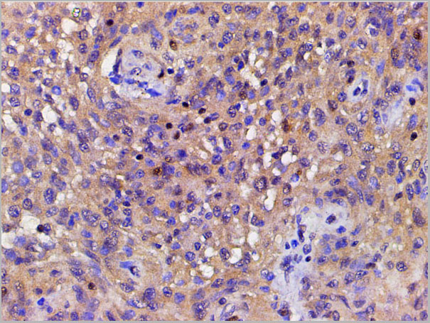 product-image-AAA31025_IHC2.jpg