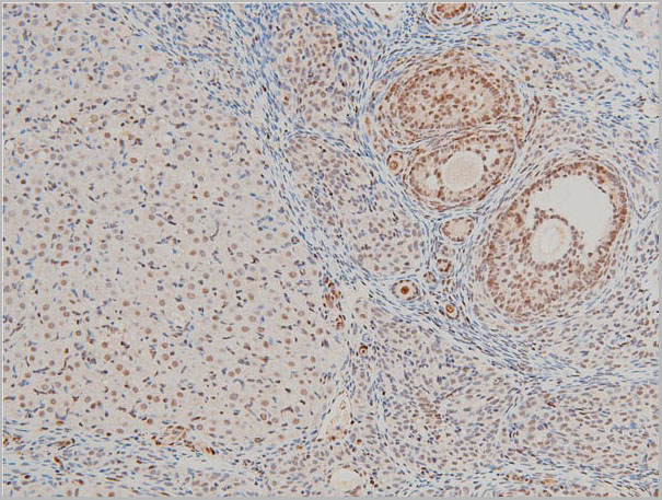 product-image-AAA31025_IHC20.jpg