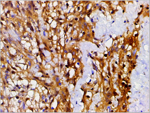 product-image-AAA31025_IHC3.jpg