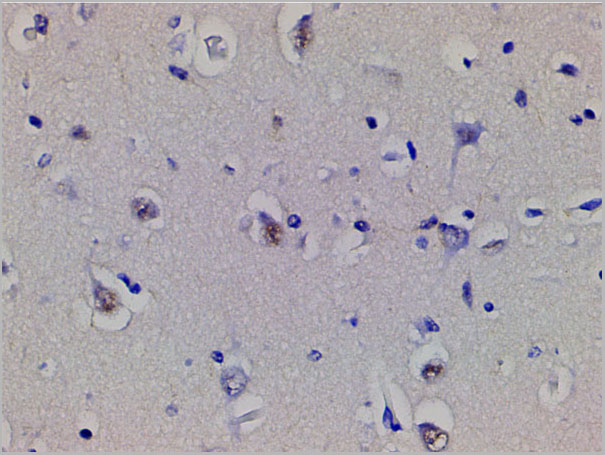 product-image-AAA31025_IHC4.jpg