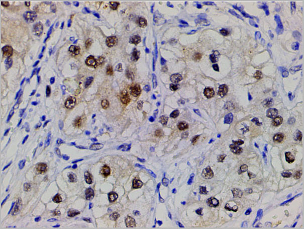 product-image-AAA31025_IHC6.jpg