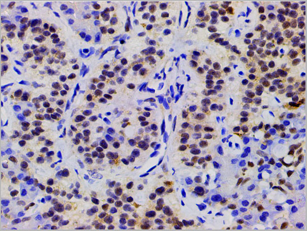 product-image-AAA31025_IHC7.jpg