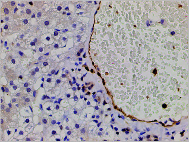 product-image-AAA31025_IHC8.jpg