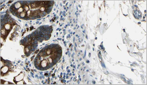 product-image-AAA31026_IHC4.jpg