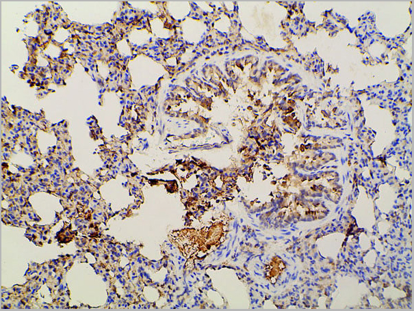 product-image-AAA31027_IHC12.jpg