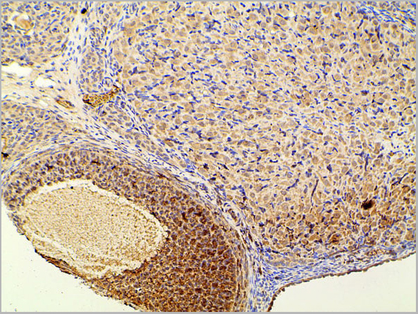 product-image-AAA31027_IHC13.jpg