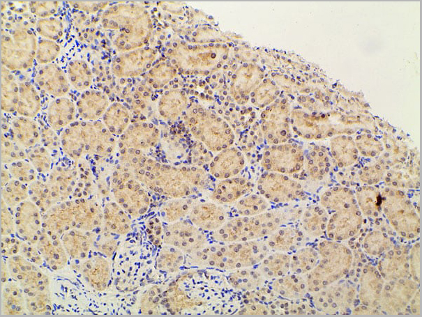product-image-AAA31027_IHC14.jpg