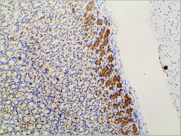 product-image-AAA31027_IHC15.jpg