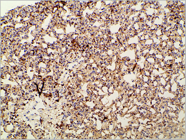 product-image-AAA31027_IHC17.jpg