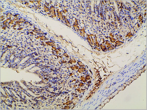 product-image-AAA31027_IHC18.jpg