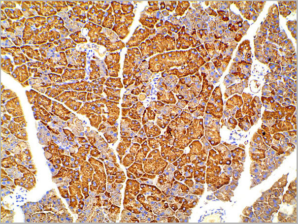 product-image-AAA31027_IHC19.jpg