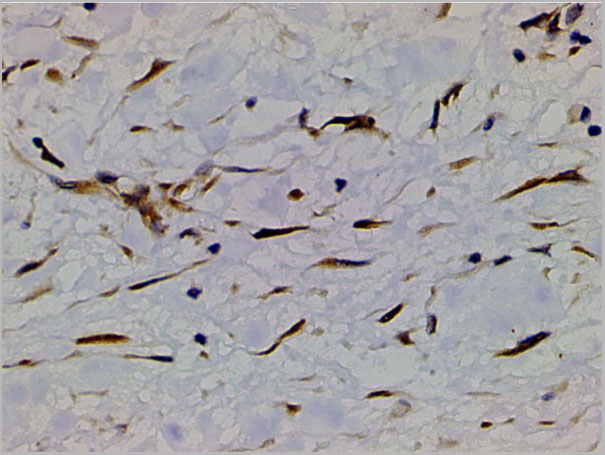 product-image-AAA31027_IHC2.jpg