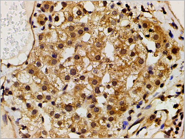 product-image-AAA31027_IHC4.jpg