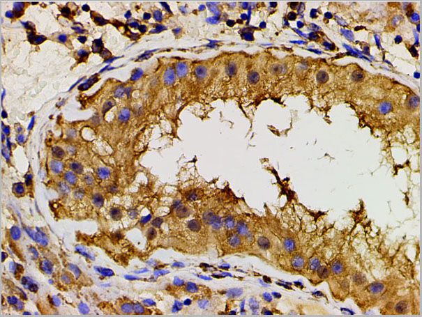 product-image-AAA31027_IHC5.jpg