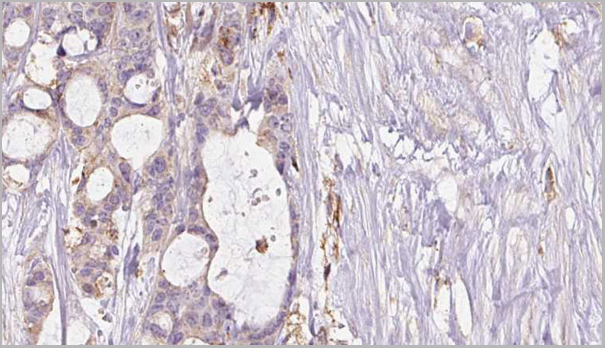 product-image-AAA31028_IHC2.jpg