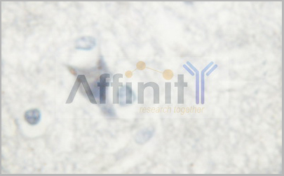 product-image-AAA31028_IHC3.jpg