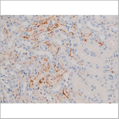 product-image-AAA31029_IHC11.jpg