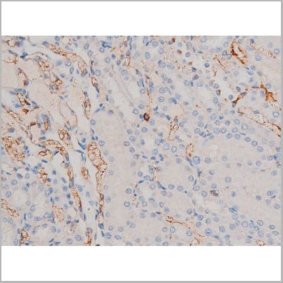 product-image-AAA31029_IHC12.jpg