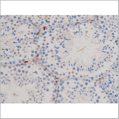 product-image-AAA31029_IHC2.jpg