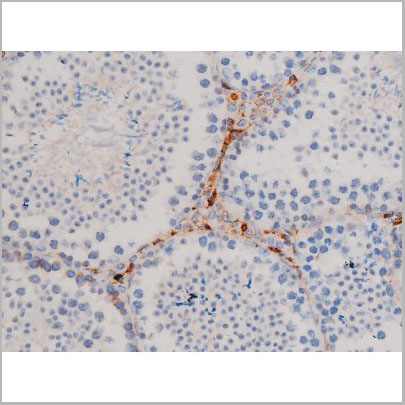 product-image-AAA31029_IHC3.jpg