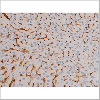 product-image-AAA31029_IHC5.jpg