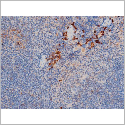 product-image-AAA31029_IHC8.jpg