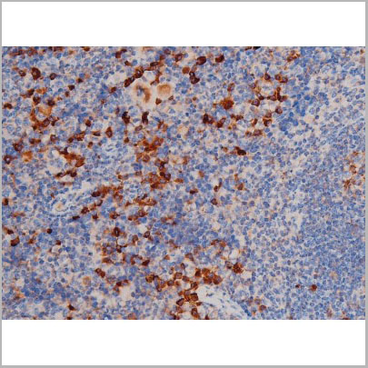 product-image-AAA31029_IHC9.jpg