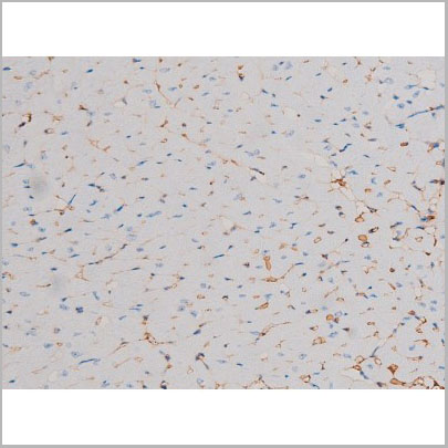 product-image-AAA31030_IHC3.jpg