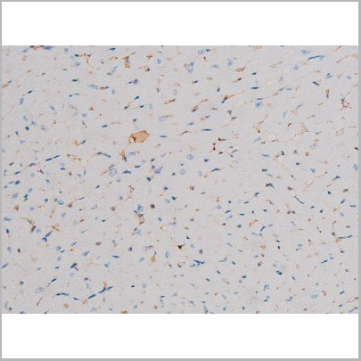 product-image-AAA31030_IHC4.jpg