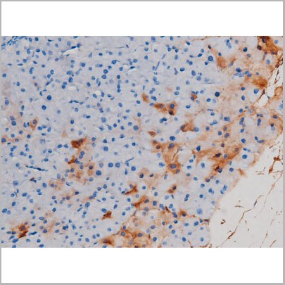 product-image-AAA31030_IHC6.jpg
