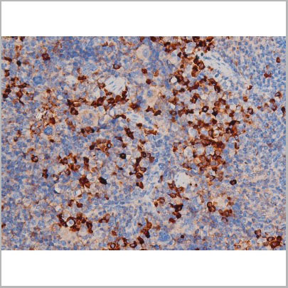 product-image-AAA31030_IHC8.jpg