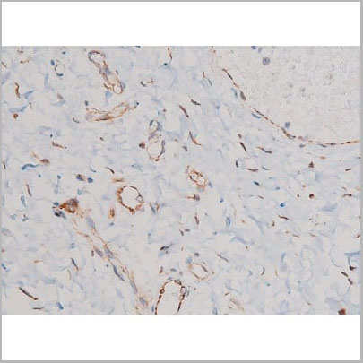 product-image-AAA31031_IHC2.jpg