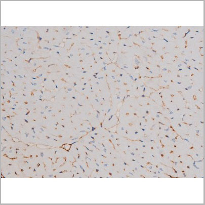 product-image-AAA31031_IHC3.jpg