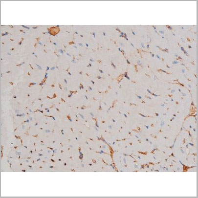 product-image-AAA31031_IHC4.jpg