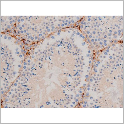 product-image-AAA31031_IHC5.jpg