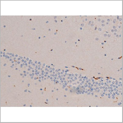 product-image-AAA31031_IHC6.jpg