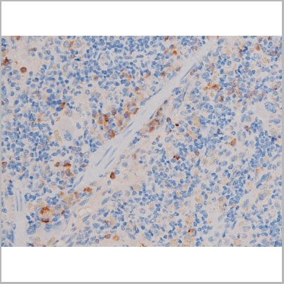 product-image-AAA31031_IHC9.jpg
