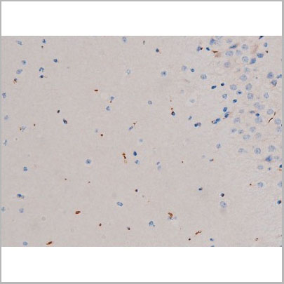 product-image-AAA31032_IHC2.jpg