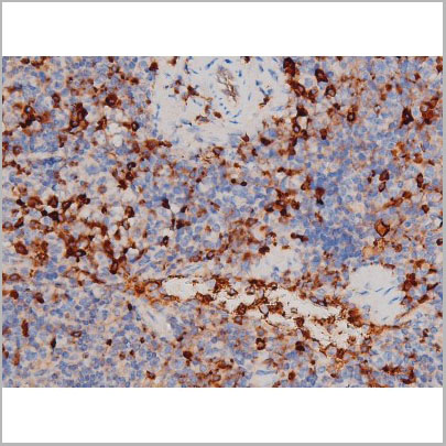 product-image-AAA31032_IHC3.jpg