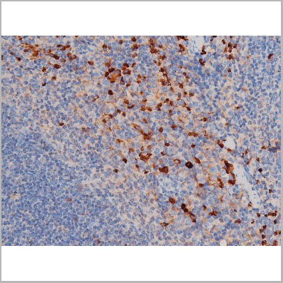 product-image-AAA31032_IHC4.jpg