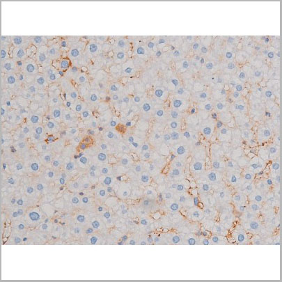 product-image-AAA31032_IHC5.jpg