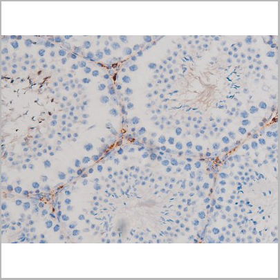product-image-AAA31033_IHC3.jpg