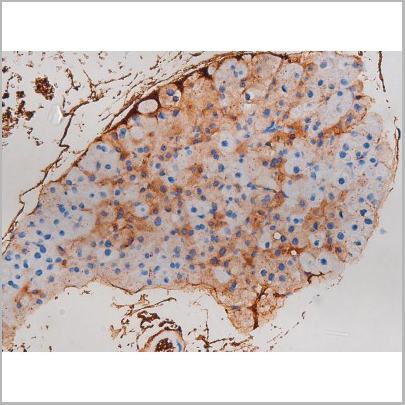 product-image-AAA31033_IHC4.jpg
