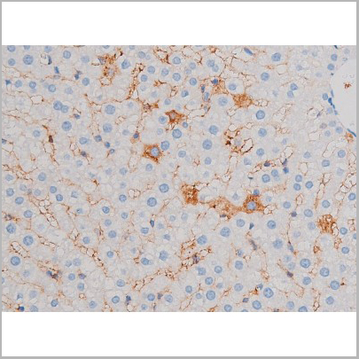 product-image-AAA31033_IHC5.jpg