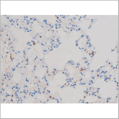product-image-AAA31033_IHC6.jpg