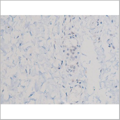 product-image-AAA31034_IHC2.jpg