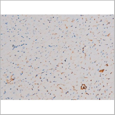 product-image-AAA31034_IHC3.jpg