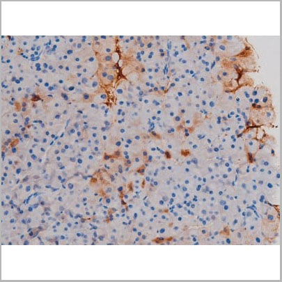 product-image-AAA31034_IHC4.jpg