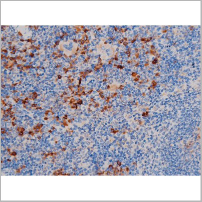 product-image-AAA31034_IHC5.jpg