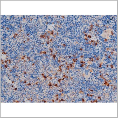 product-image-AAA31034_IHC6.jpg